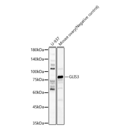 Western Blot - Anti-GLIS3 Antibody (A80948) - Antibodies.com