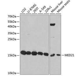 Western Blot - Anti-Surb7 Antibody (A80949) - Antibodies.com