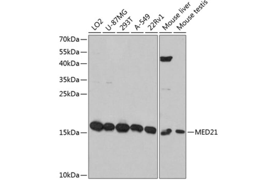Western Blot - Anti-Surb7 Antibody (A80949) - Antibodies.com