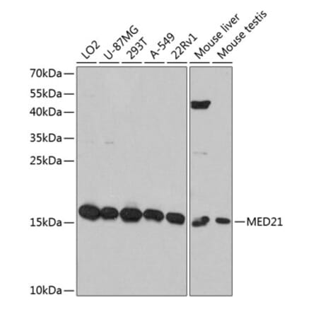 Western Blot - Anti-Surb7 Antibody (A80949) - Antibodies.com