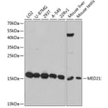 Western Blot - Anti-Surb7 Antibody (A80949) - Antibodies.com