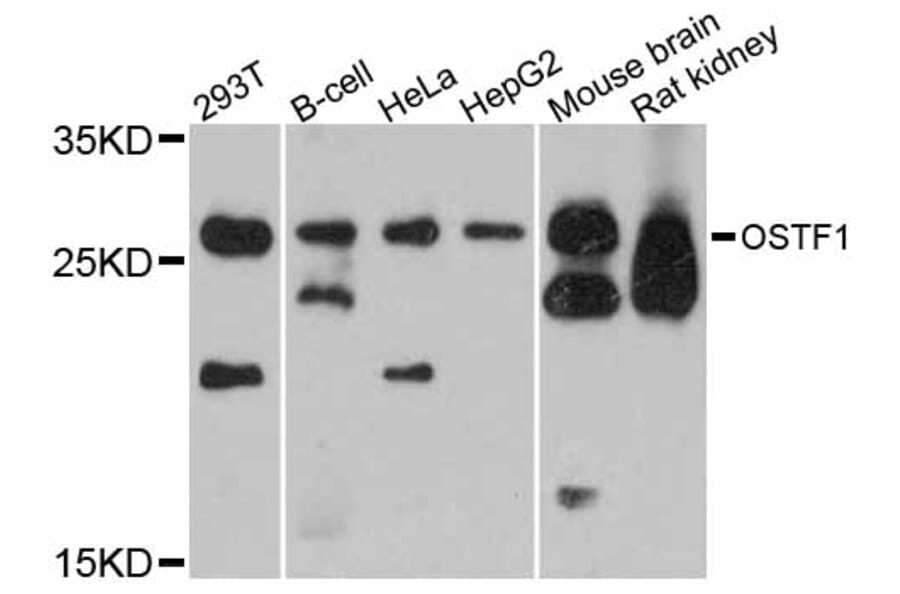 Western Blot - Anti-OSTF1 Antibody (A12169) - Antibodies.com
