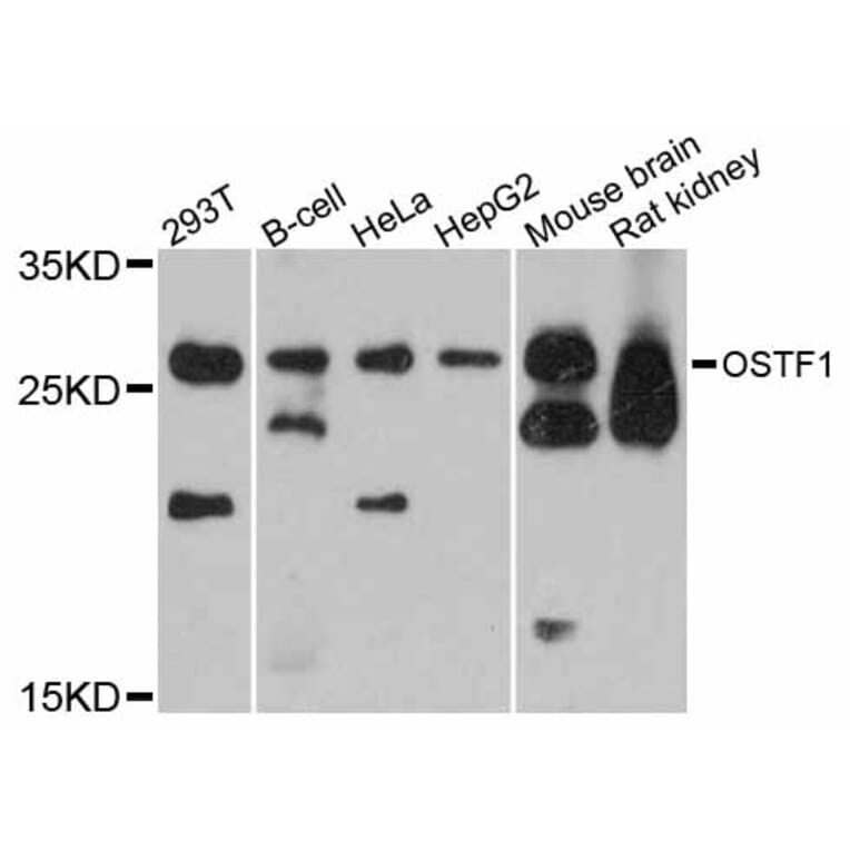 Western Blot - Anti-OSTF1 Antibody (A12169) - Antibodies.com