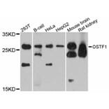 Western Blot - Anti-OSTF1 Antibody (A12169) - Antibodies.com