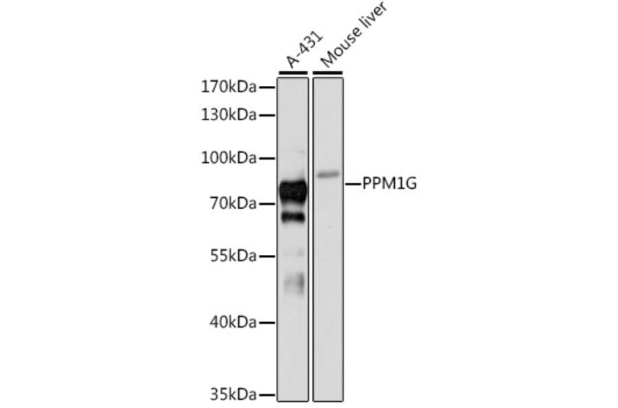 Western Blot - Anti-PPM1G Antibody (A12173) - Antibodies.com