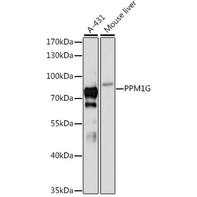 Western Blot - Anti-PPM1G Antibody (A12173) - Antibodies.com
