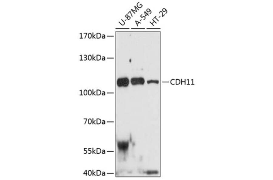 Western Blot - Anti-OB Cadherin Antibody (A80952) - Antibodies.com