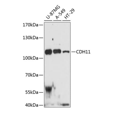 Western Blot - Anti-OB Cadherin Antibody (A80952) - Antibodies.com