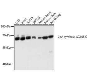 Western Blot - Anti-COASY Antibody (A80953) - Antibodies.com