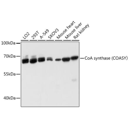 Western Blot - Anti-COASY Antibody (A80953) - Antibodies.com