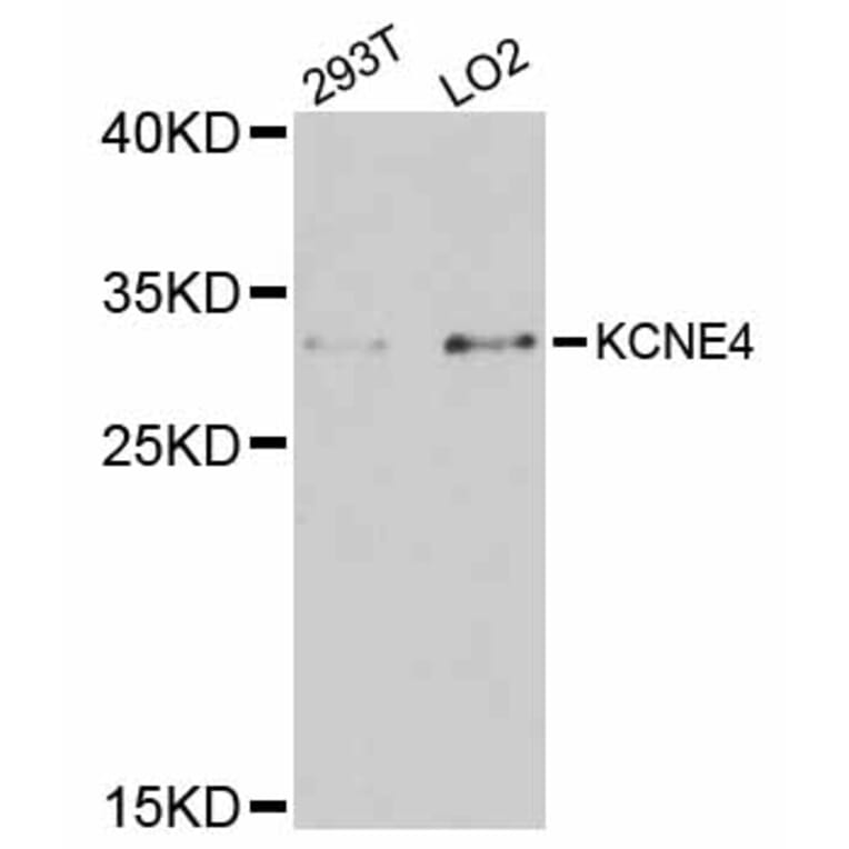 Western Blot - Anti-KCNE4 Antibody (A12184) - Antibodies.com