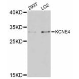 Western Blot - Anti-KCNE4 Antibody (A12184) - Antibodies.com