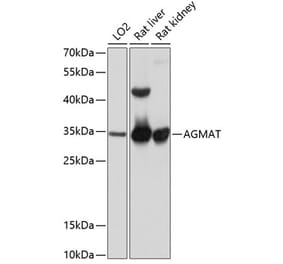 Western Blot - Anti-AGMAT Antibody (A80956) - Antibodies.com