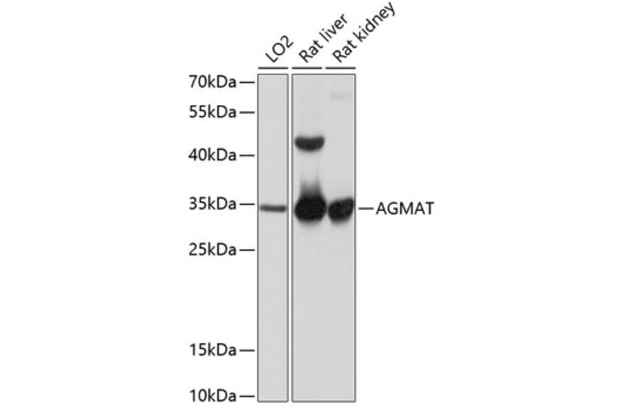 Western Blot - Anti-AGMAT Antibody (A80956) - Antibodies.com