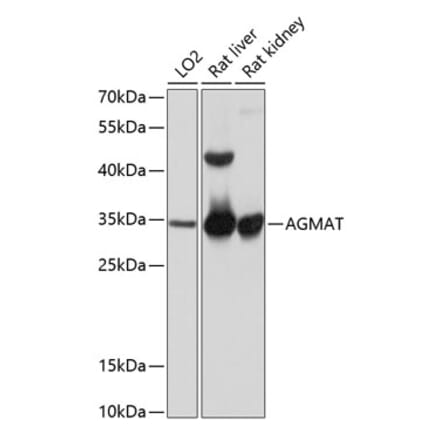 Western Blot - Anti-AGMAT Antibody (A80956) - Antibodies.com