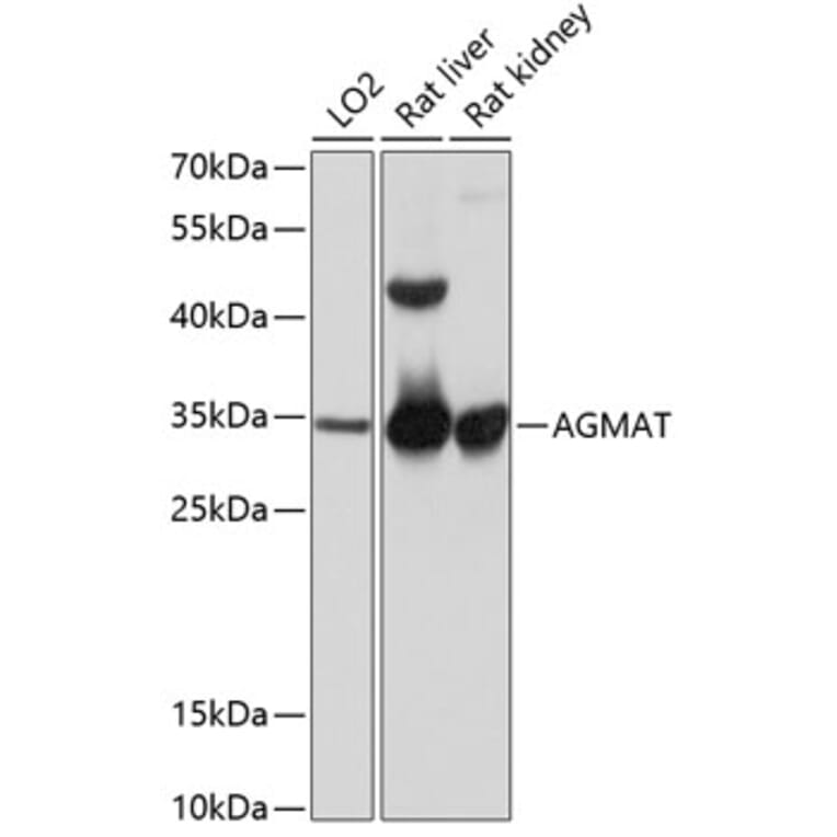 Western Blot - Anti-AGMAT Antibody (A80956) - Antibodies.com