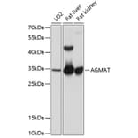 Western Blot - Anti-AGMAT Antibody (A80956) - Antibodies.com