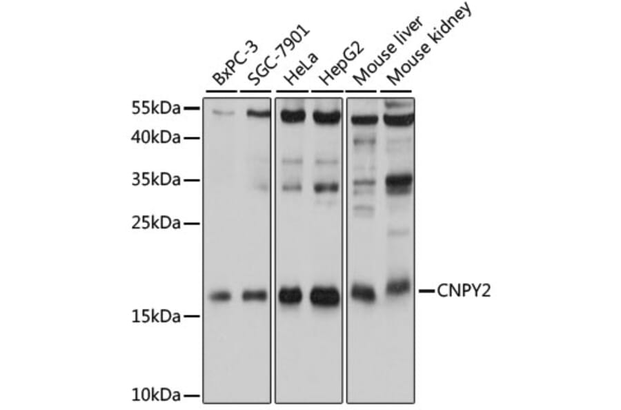 Western Blot - Anti-CNPY2/MSAP Antibody (A80957) - Antibodies.com