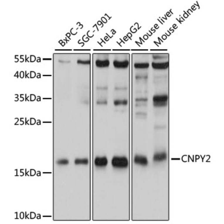Western Blot - Anti-CNPY2/MSAP Antibody (A80957) - Antibodies.com