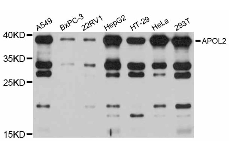 Western Blot - Anti-APOL2 Antibody (A12202) - Antibodies.com