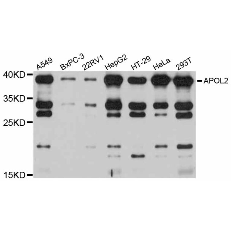 Western Blot - Anti-APOL2 Antibody (A12202) - Antibodies.com