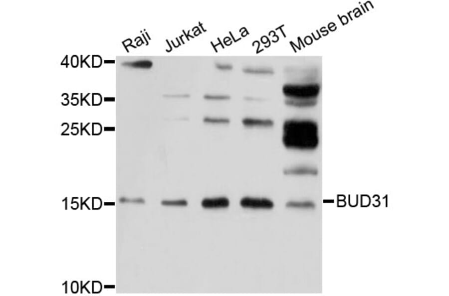 Western Blot - Anti-BUD31 Antibody (A12205) - Antibodies.com