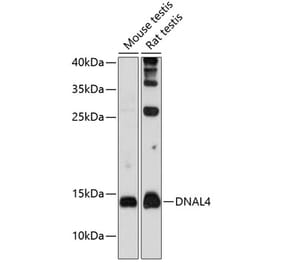 Western Blot - Anti-Dynein light chain Antibody (A80962) - Antibodies.com