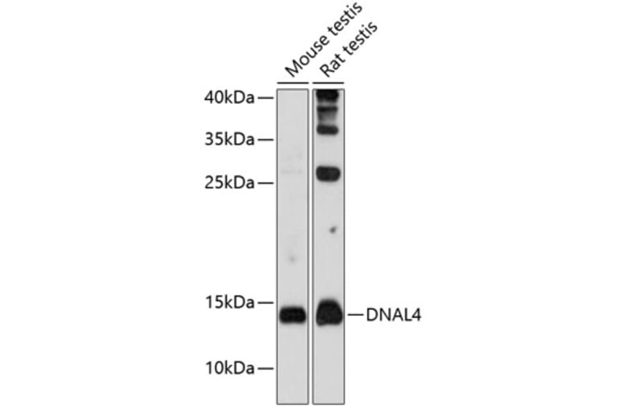 Western Blot - Anti-Dynein light chain Antibody (A80962) - Antibodies.com