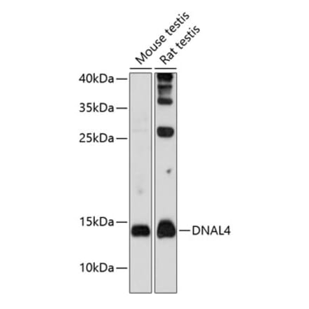 Western Blot - Anti-Dynein light chain Antibody (A80962) - Antibodies.com