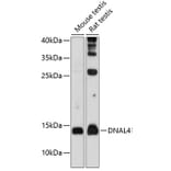 Western Blot - Anti-Dynein light chain Antibody (A80962) - Antibodies.com