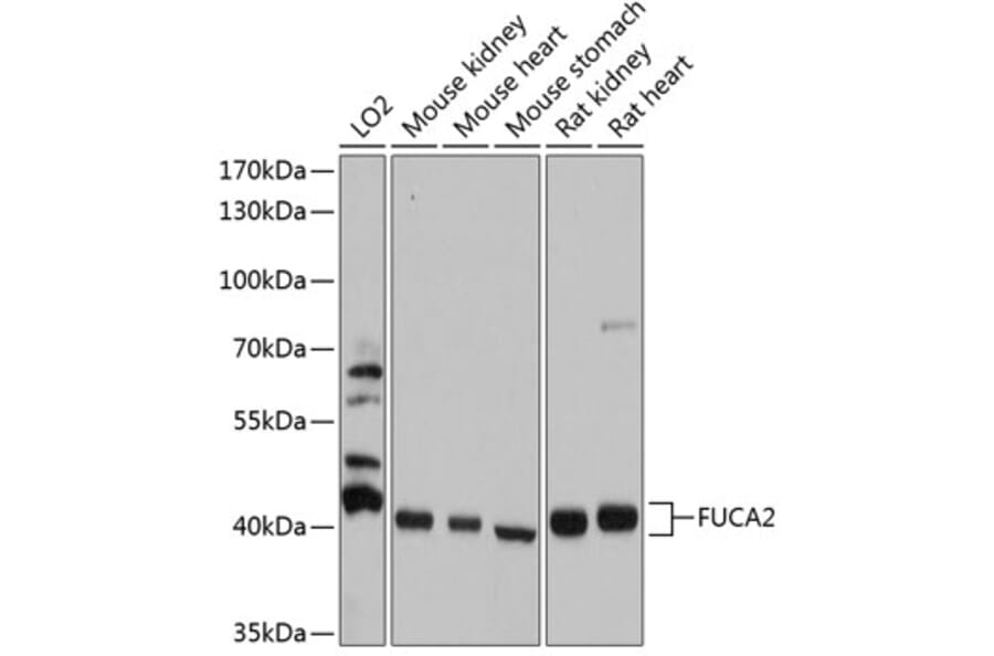 Western Blot - Anti-FUCA2 Antibody (A80964) - Antibodies.com