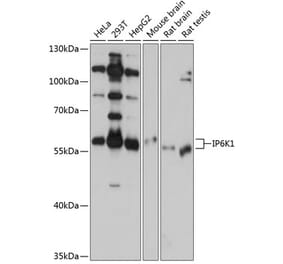 Western Blot - Anti-IP6K1 Antibody (A80965) - Antibodies.com