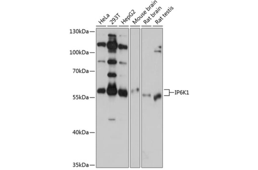 Western Blot - Anti-IP6K1 Antibody (A80965) - Antibodies.com