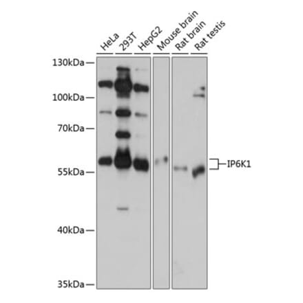 Western Blot - Anti-IP6K1 Antibody (A80965) - Antibodies.com