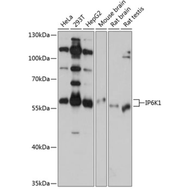 Western Blot - Anti-IP6K1 Antibody (A80965) - Antibodies.com