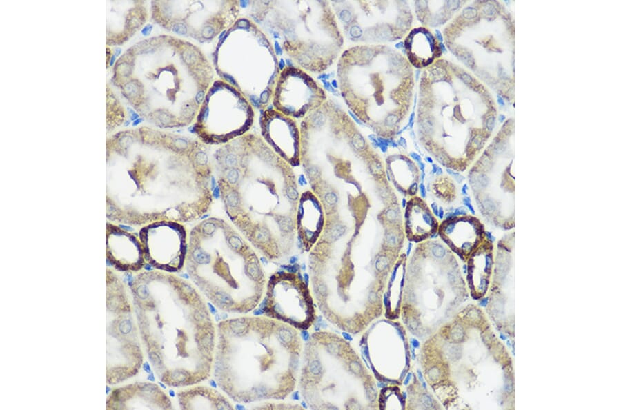 Immunohistochemistry - Anti-IP6K1 Antibody (A80965) - Antibodies.com