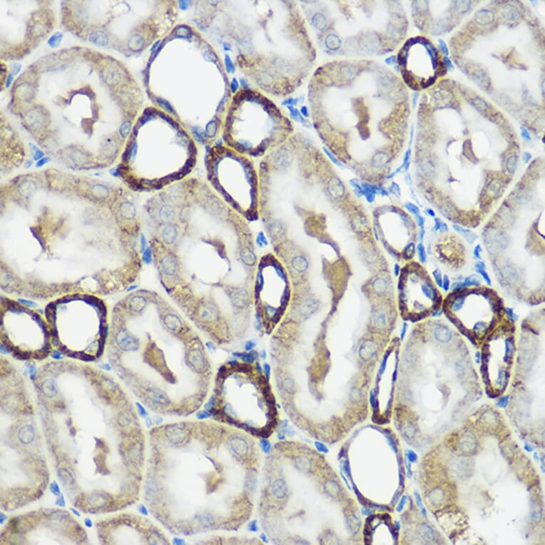 Immunohistochemistry - Anti-IP6K1 Antibody (A80965) - Antibodies.com