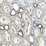 Immunohistochemistry - Anti-IP6K1 Antibody (A80965) - Antibodies.com