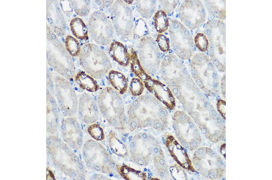 Immunohistochemistry - Anti-IP6K1 Antibody (A80965) - Antibodies.com