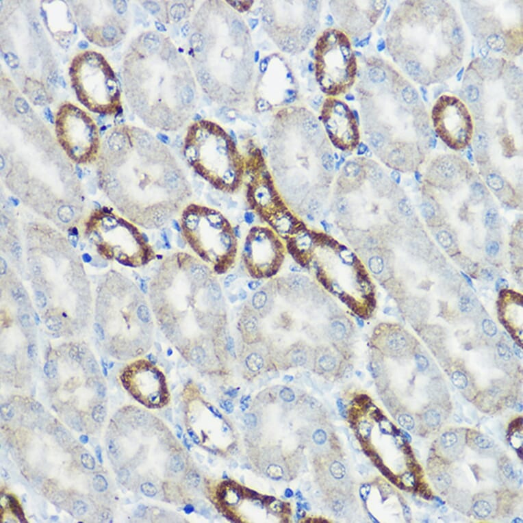 Immunohistochemistry - Anti-IP6K1 Antibody (A80965) - Antibodies.com