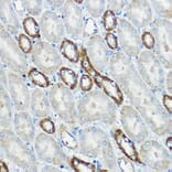 Immunohistochemistry - Anti-IP6K1 Antibody (A80965) - Antibodies.com