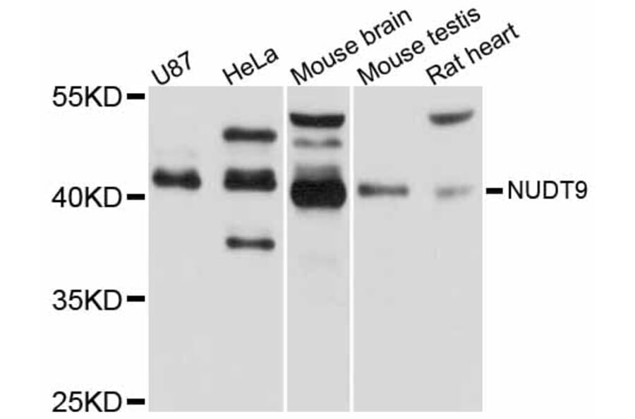 Western Blot - Anti-NUDT9 Antibody (A12220) - Antibodies.com