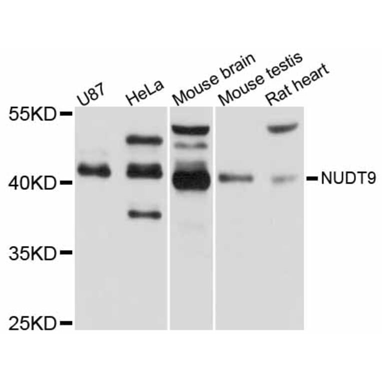 Western Blot - Anti-NUDT9 Antibody (A12220) - Antibodies.com