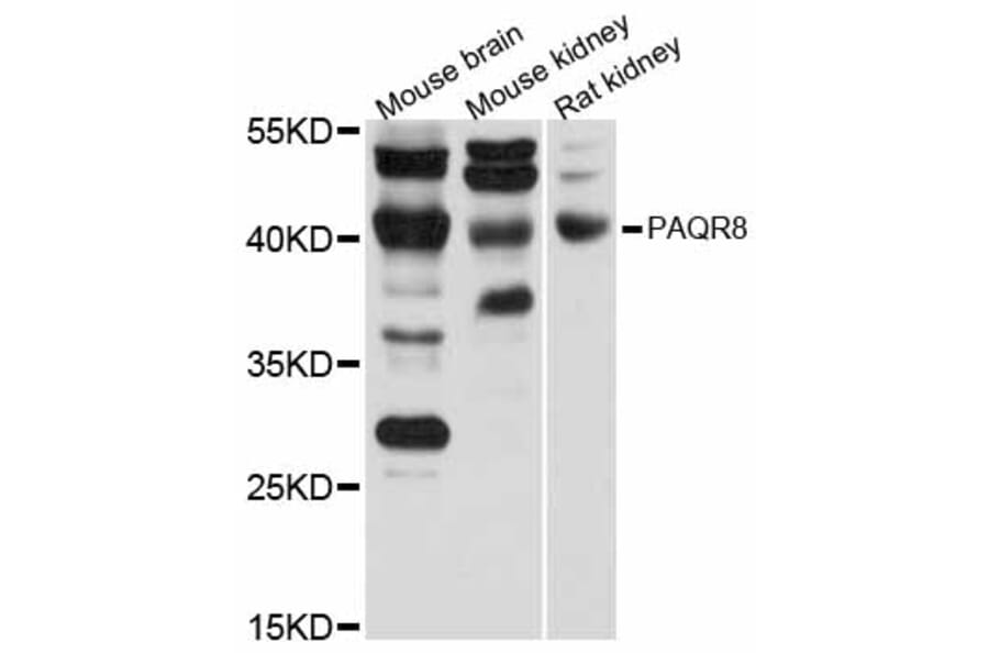 Western Blot - Anti-PAQR8 Antibody (A12221) - Antibodies.com