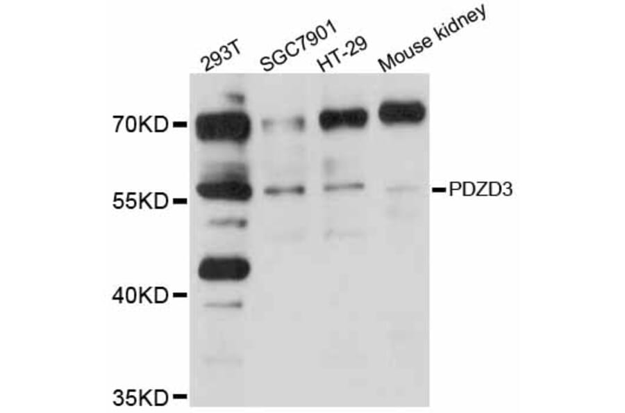 Western Blot - Anti-PDZD3 Antibody (A12222) - Antibodies.com