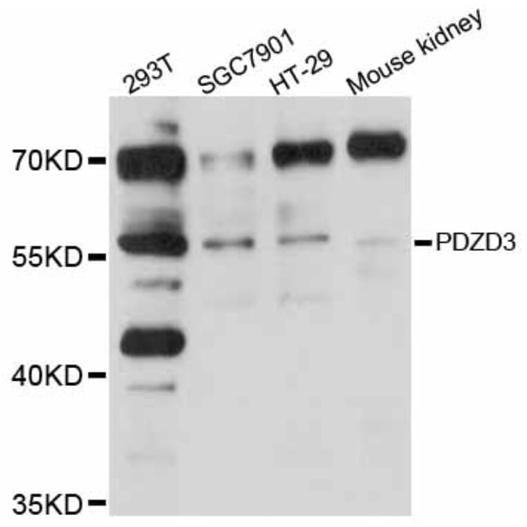 Western Blot - Anti-PDZD3 Antibody (A12222) - Antibodies.com