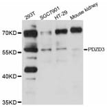 Western Blot - Anti-PDZD3 Antibody (A12222) - Antibodies.com