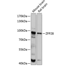 Western Blot - Anti-ZFP28 Antibody (A80971) - Antibodies.com