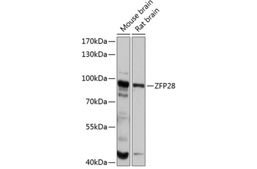 Western Blot - Anti-ZFP28 Antibody (A80971) - Antibodies.com