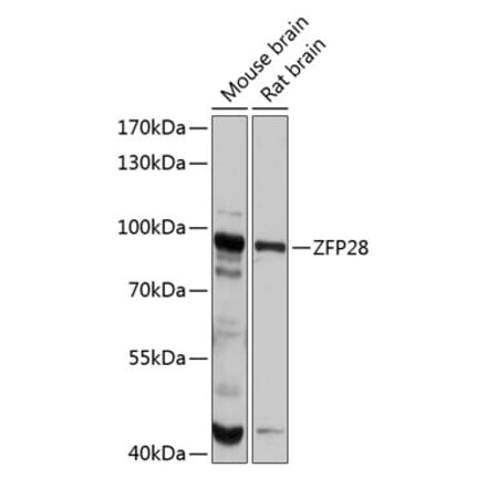 Western Blot - Anti-ZFP28 Antibody (A80971) - Antibodies.com